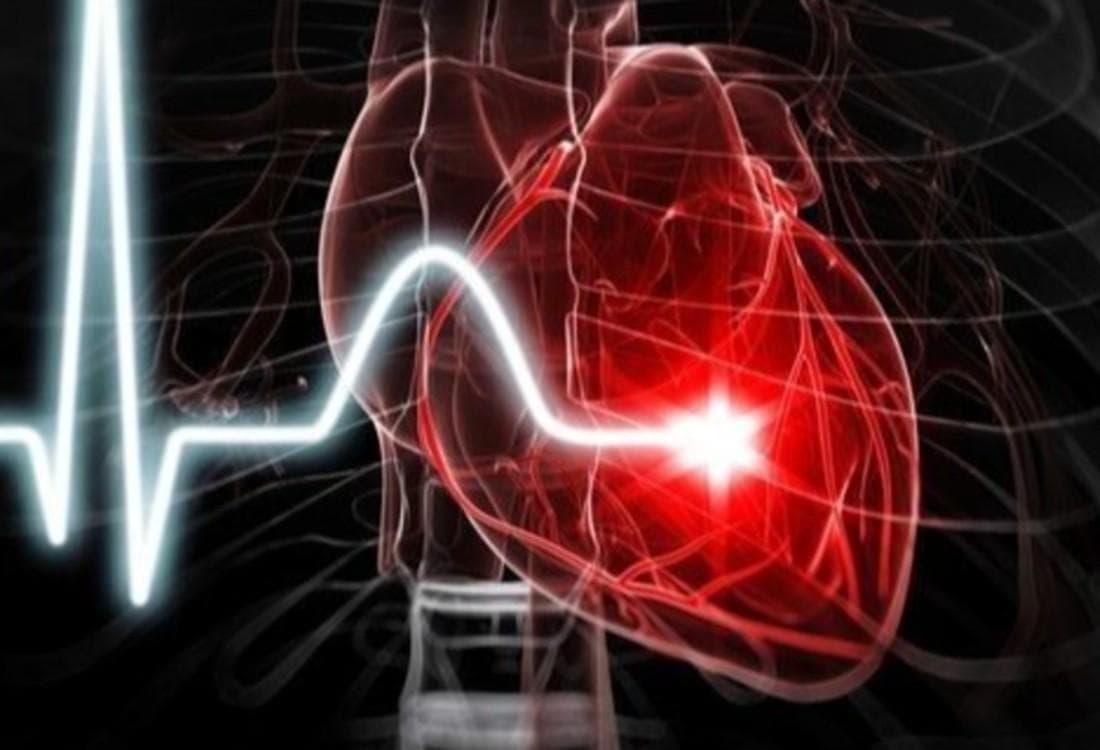 Cardiology